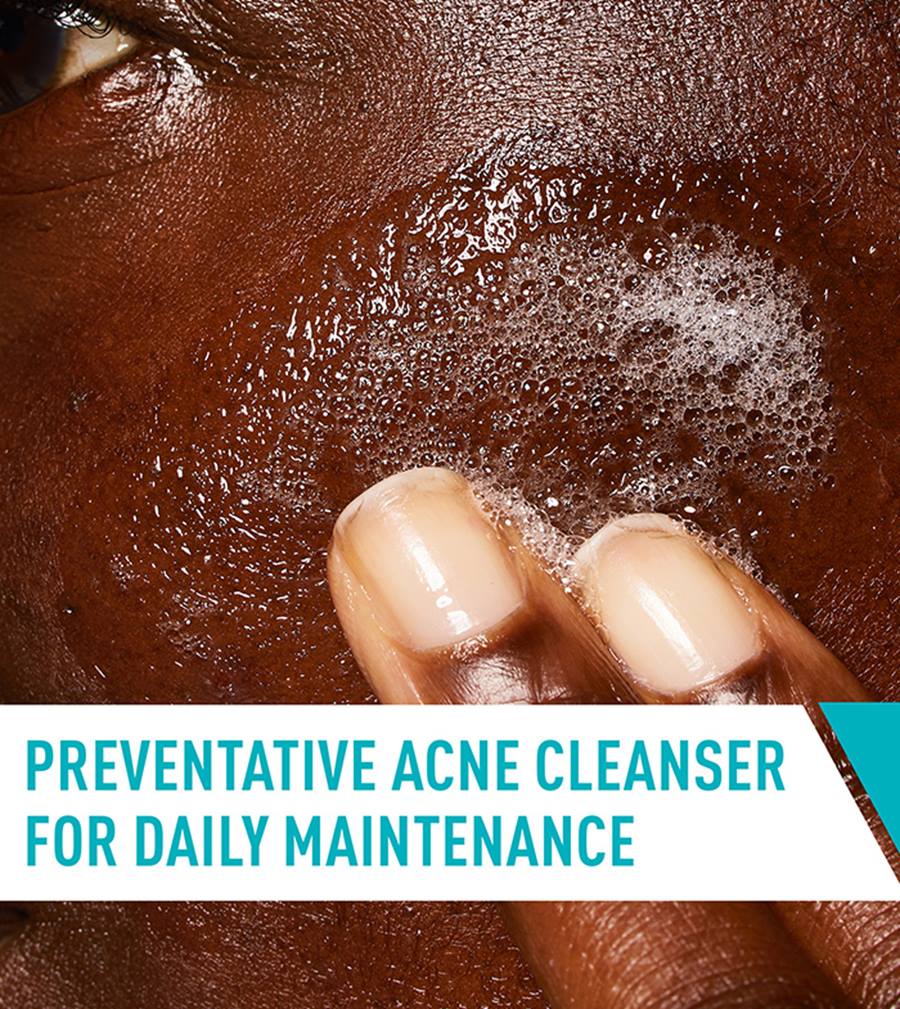 Acne Control Cleanser